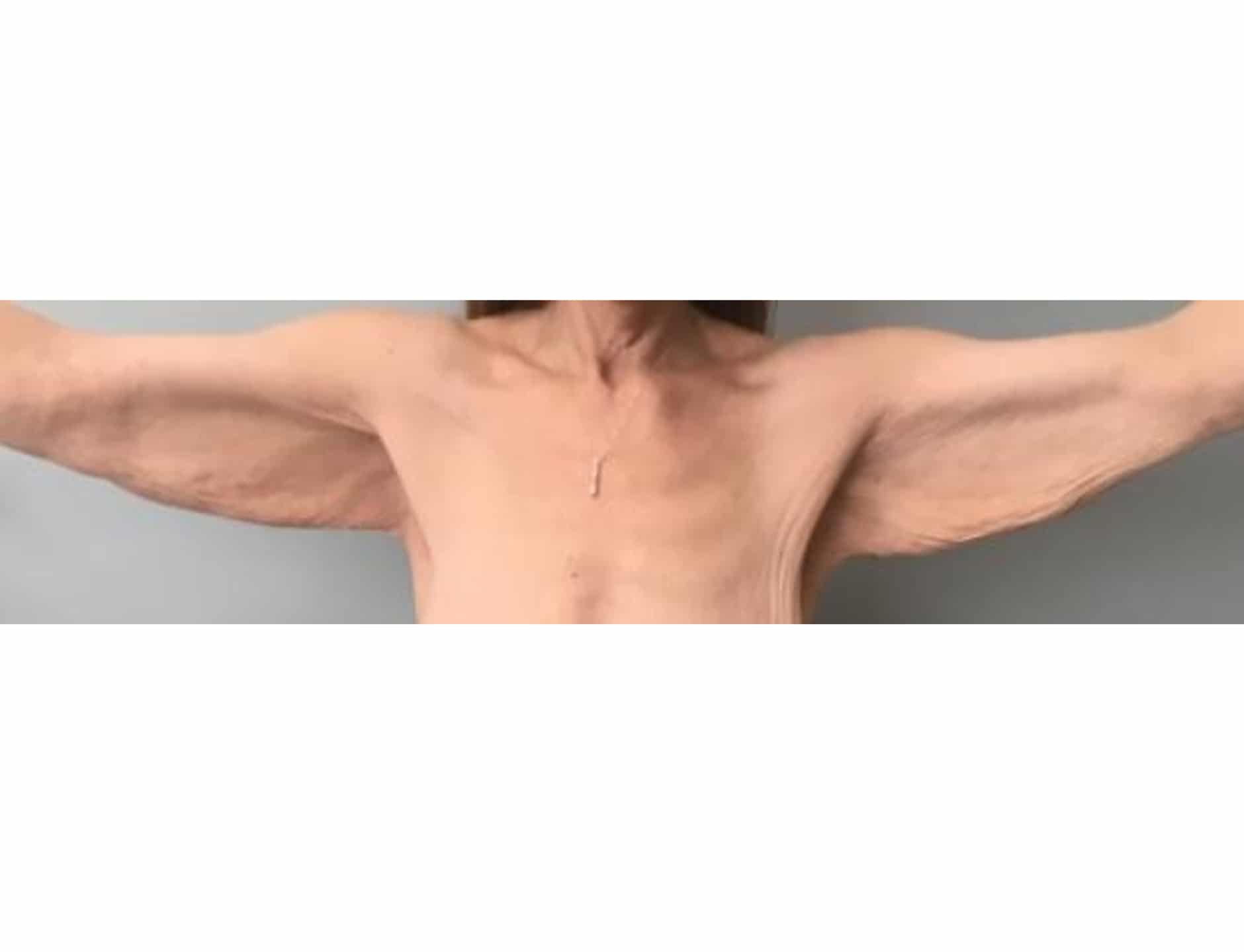 Brachio BA 01 Brachio BA 01