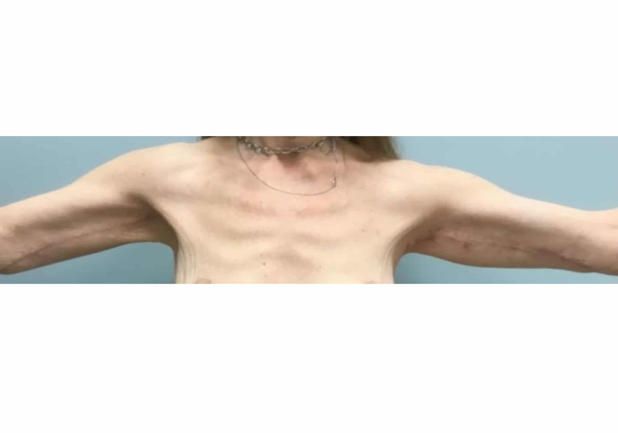 Brachio BA 04 Brachio BA 04