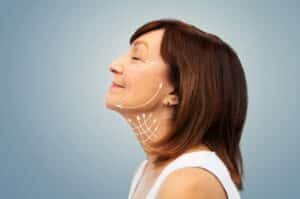 Facelift vs. Neck Lift: Which is Right for You? 1 senior woman profile face and neck marks