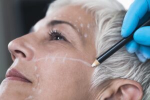Facelift vs. Neck Lift: Which is Right for You? 3 grey haired woman getting facelift marks