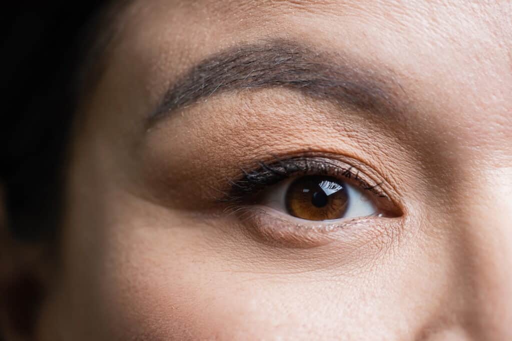 Blepharoplasty CT