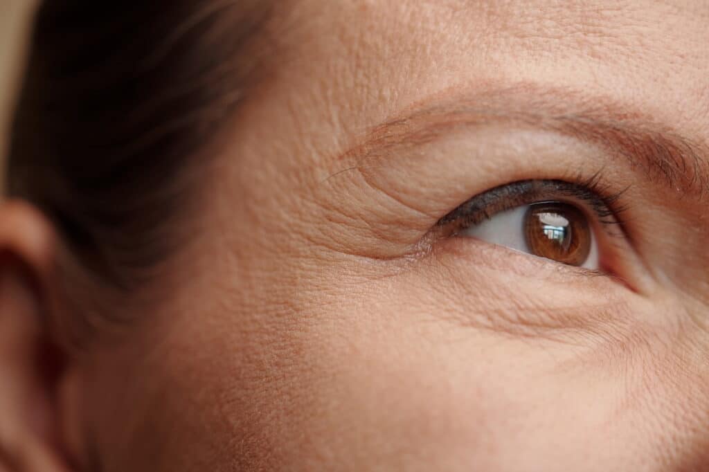 Brow Lift Surgery