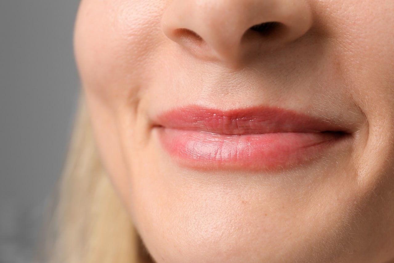 Lip Lift Surgery
