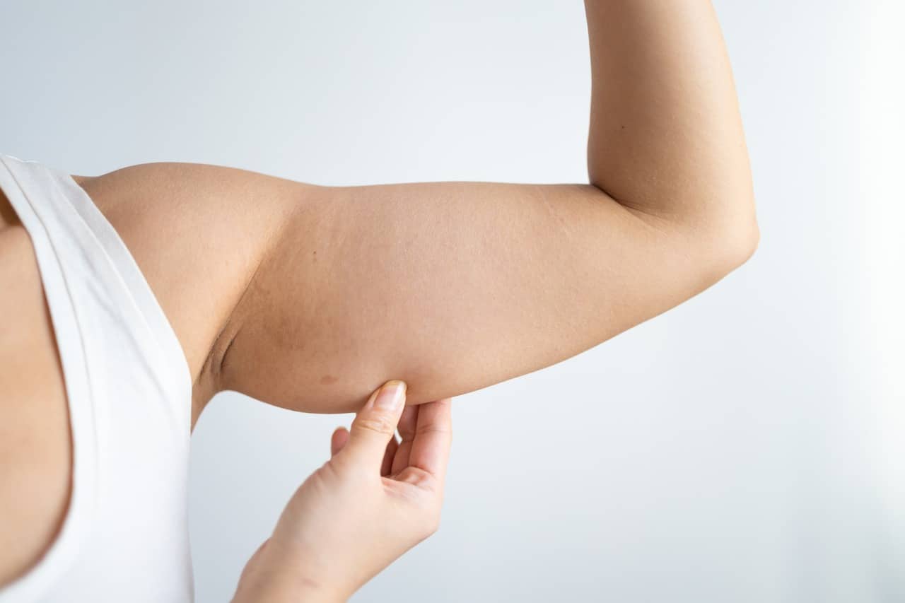 arm liposuction procedure