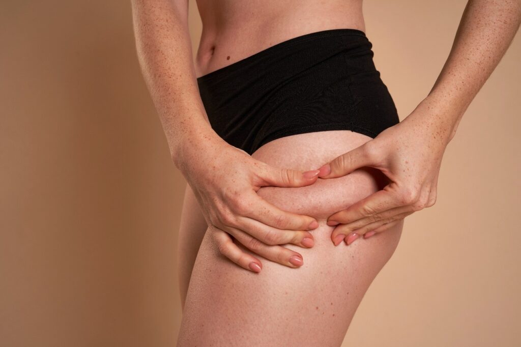 thigh liposuction procedure