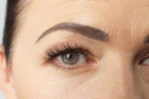 What Is an Endoscopic Brow Lift? 3 extreme close up of an old woman's eye
