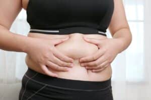 Does the Fat Come Back After Liposuction? 2 woman squeezing her belly fat